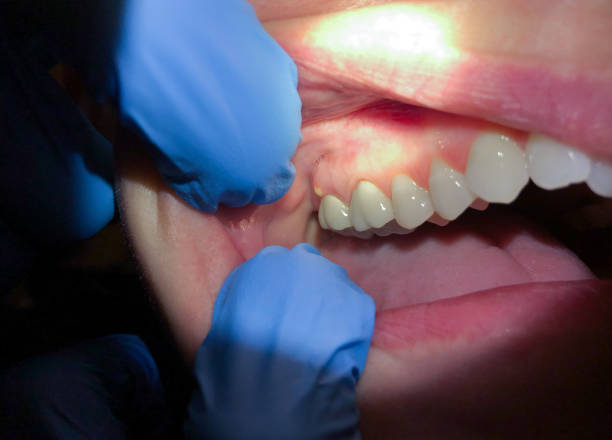 Best Broken Tooth Emergency  in Amboy, IL